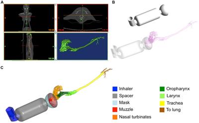 Salbutamol transport and deposition in healthy cat airways under different breathing conditions and particle sizes